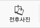 전후사진